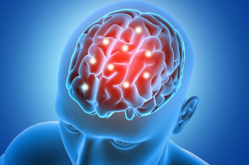 Top Brain Specialist Doctor in India – Dr. Seema Shahi