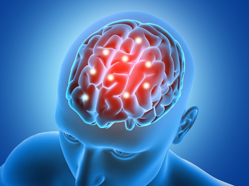 Top Brain Specialist Doctor in India – Dr. Seema Shahi